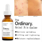 The Ordinary Retinol 1% in Squalane 30 ML - Image 3